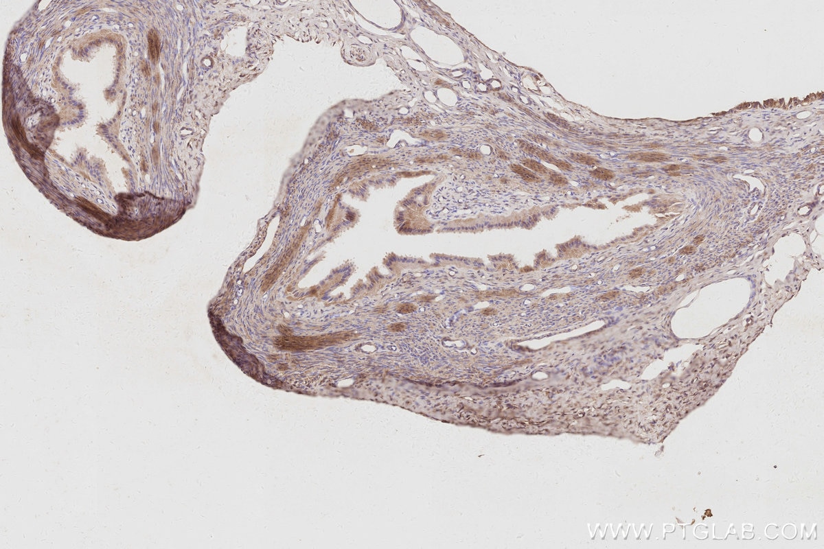 IHC staining of rat ovary using 31526-1-AP Immunohistochemistry (IHC) staining of rat ovary tissue using CDC42BPB Polyclonal antibody (31526-1-AP)