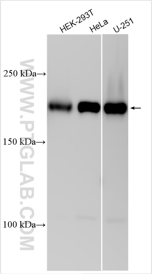 Western Blot (WB) analysis of various lysates using CDC42BPB Polyclonal antibody (31526-1-AP)