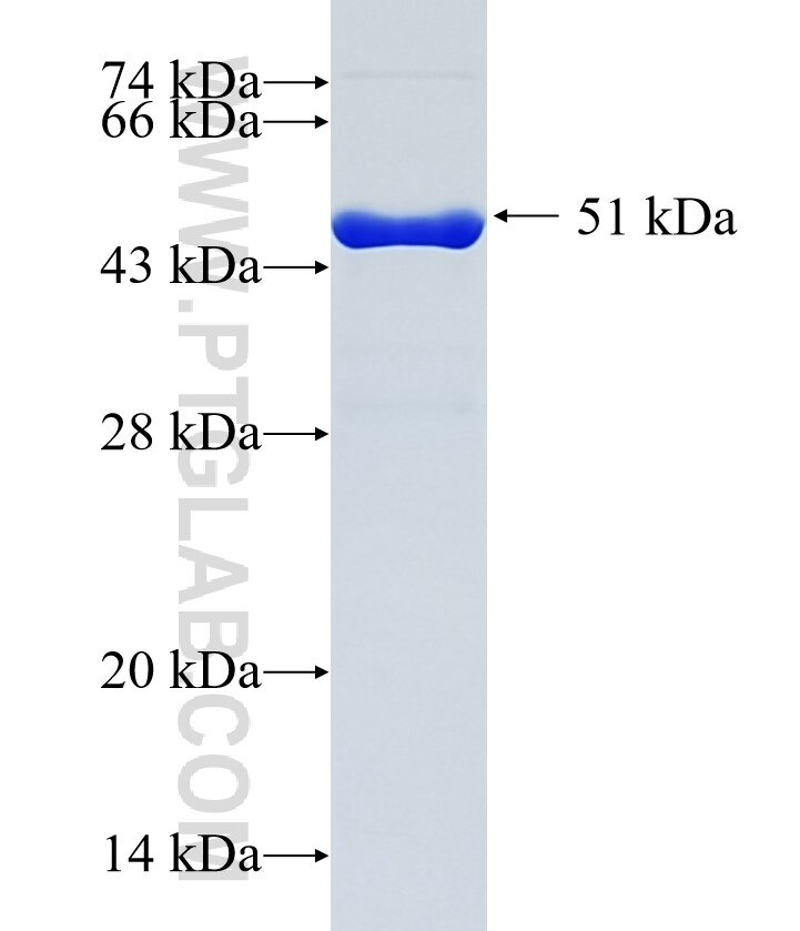 CDC42BPB fusion protein Ag35745 SDS-PAGE