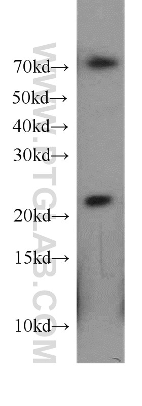 Western Blot (WB) analysis of mouse pancreas tissue using CDC42EP2 Polyclonal antibody (11824-1-AP)