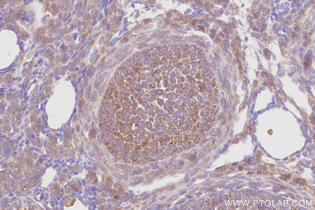Immunohistochemistry (IHC) staining of mouse ovary tissue using CDC42EP4 Polyclonal antibody (19262-1-AP)