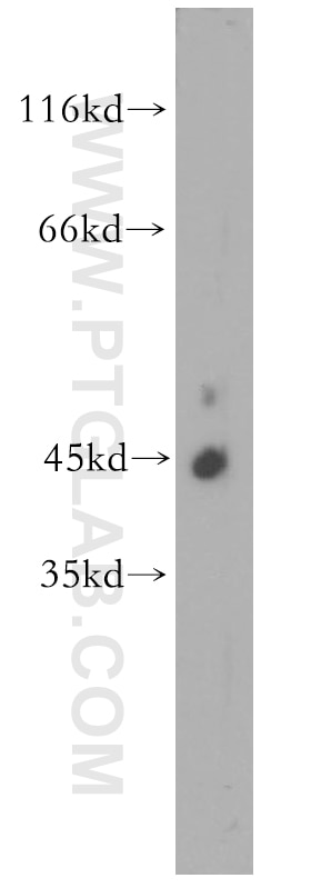 Western Blot (WB) analysis of K-562 cells using CDC42EP4 Polyclonal antibody (19262-1-AP)