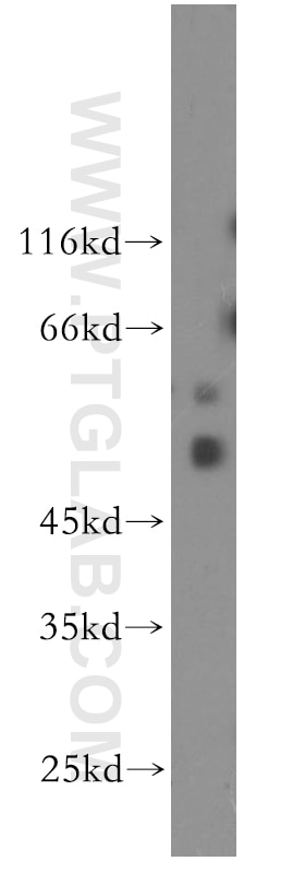 Western Blot (WB) analysis of A549 cells using CDC42EP4 Polyclonal antibody (19262-1-AP)