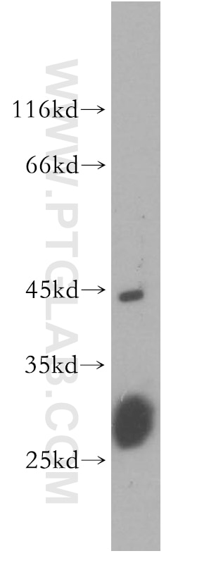 Western Blot (WB) analysis of mouse lung tissue using CDC42EP4 Polyclonal antibody (19262-1-AP)