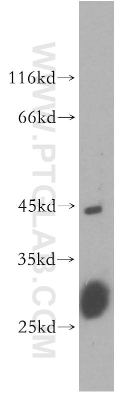 WB analysis of mouse lung using 19262-1-AP