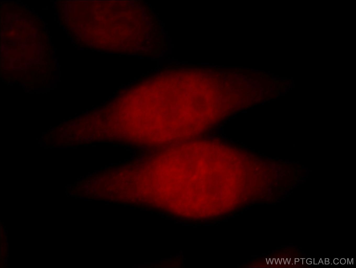 IF Staining of HeLa using 15678-1-AP