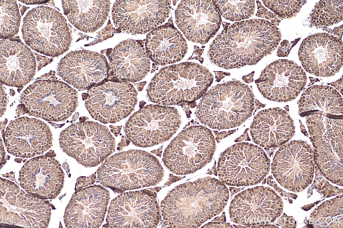 Immunohistochemistry (IHC) staining of mouse testis tissue using CDC45L Polyclonal antibody (15678-1-AP)