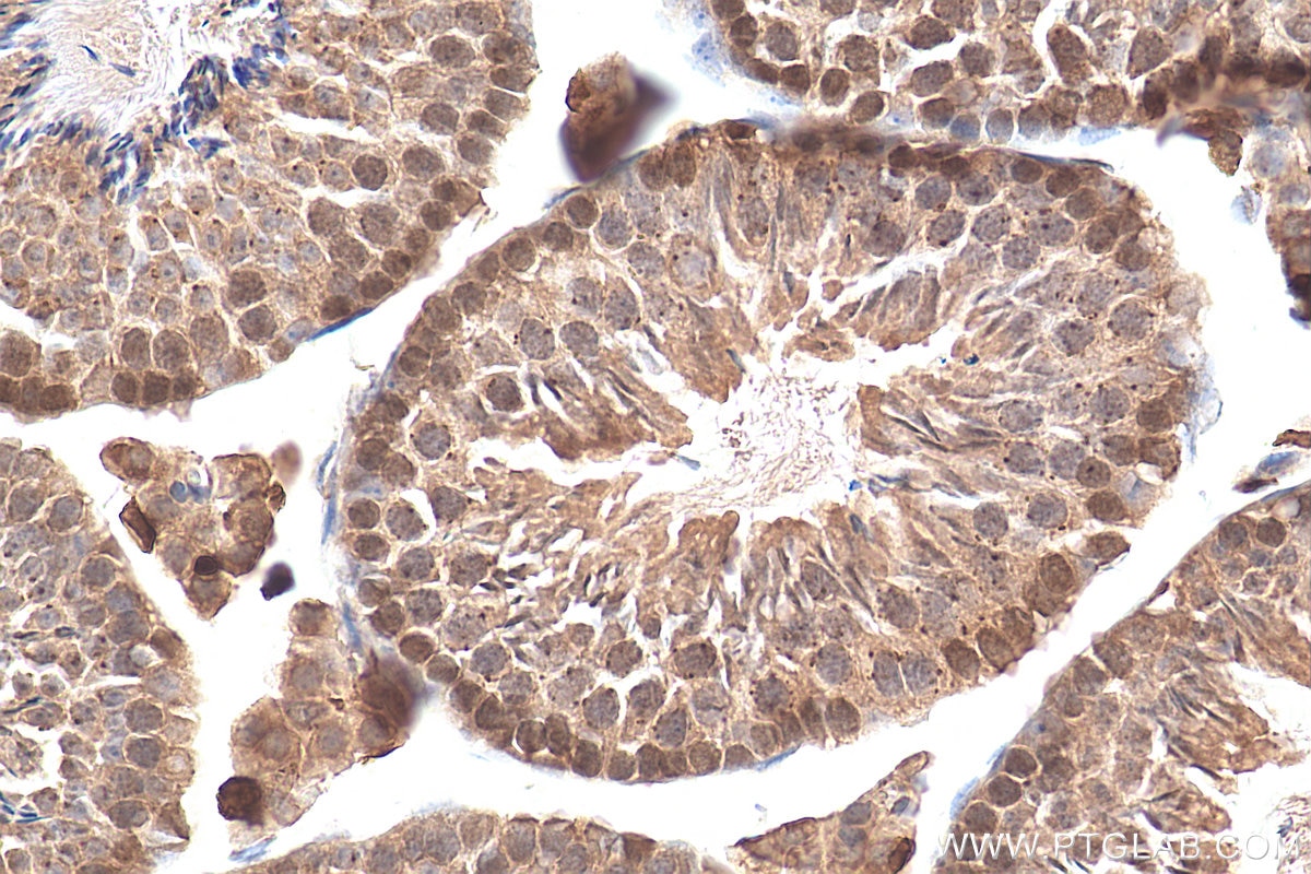 Immunohistochemistry (IHC) staining of mouse testis tissue using CDC45L Polyclonal antibody (15678-1-AP)