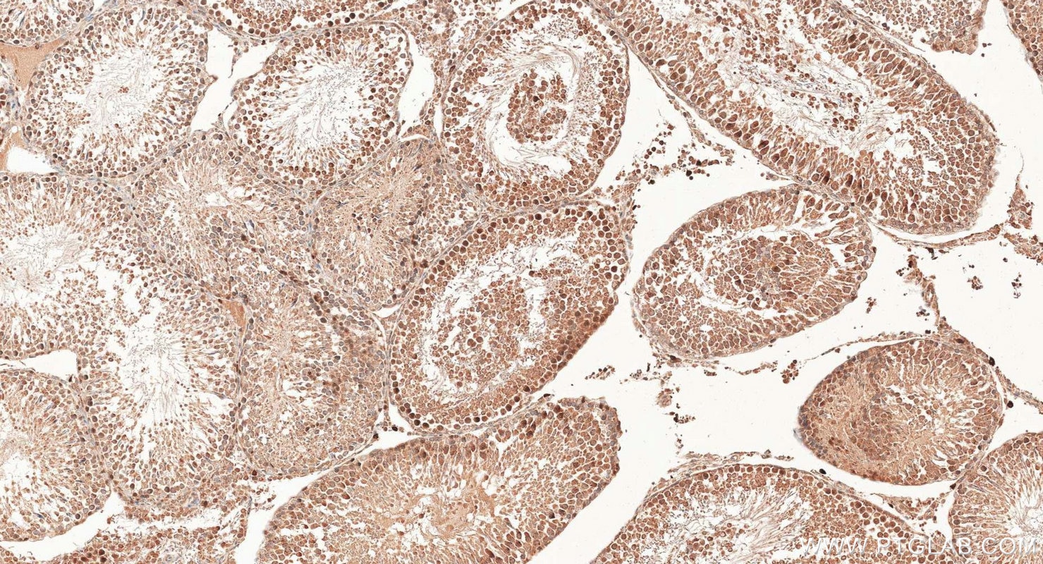 Immunohistochemistry (IHC) staining of rat testis tissue using CDC45L Polyclonal antibody (15678-1-AP)