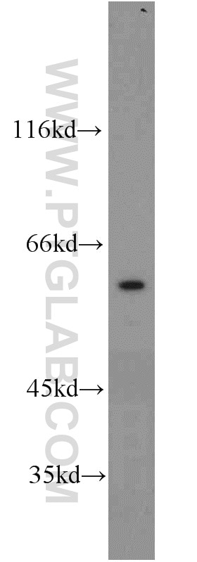 Western Blot (WB) analysis of HEK-293 cells using CDC45L Polyclonal antibody (15678-1-AP)