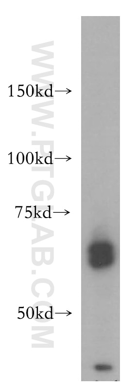 Western Blot (WB) analysis of K-562 cells using CDC45L Polyclonal antibody (15678-1-AP)