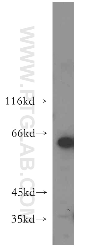 Western Blot (WB) analysis of HeLa cells using CDC45L Polyclonal antibody (15678-1-AP)