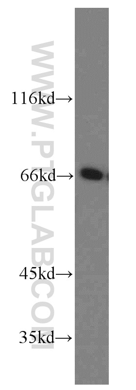 Western Blot (WB) analysis of Jurkat cells using CDC45L Polyclonal antibody (15678-1-AP)