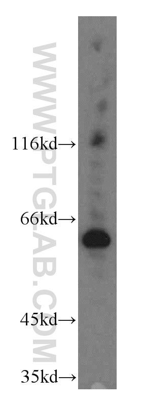 Western Blot (WB) analysis of mouse thymus tissue using CDC45L Polyclonal antibody (15678-1-AP)