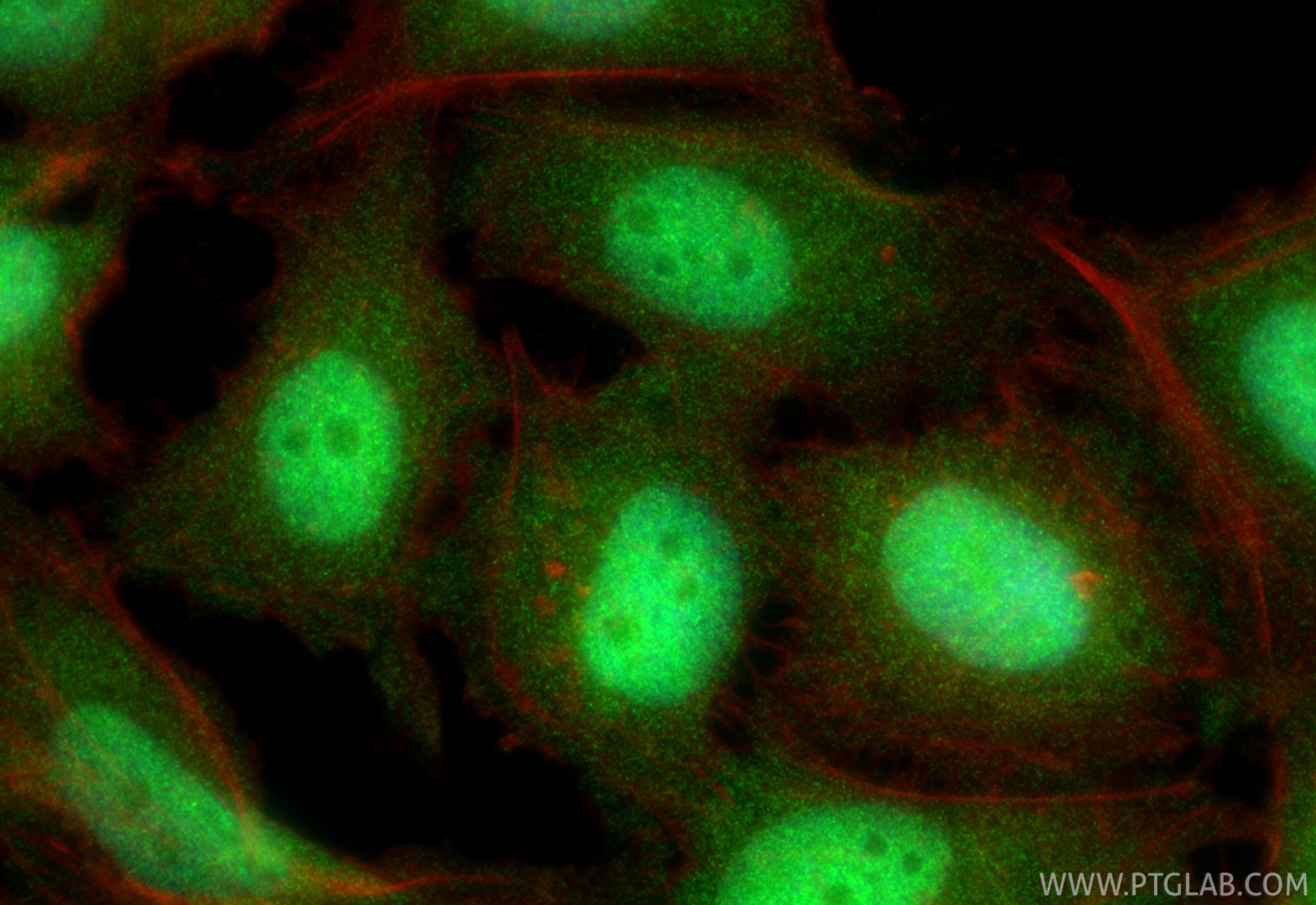 Immunofluorescence (IF) / fluorescent staining of HeLa cells using CDC45L Recombinant monoclonal antibody (87219-1-RR)