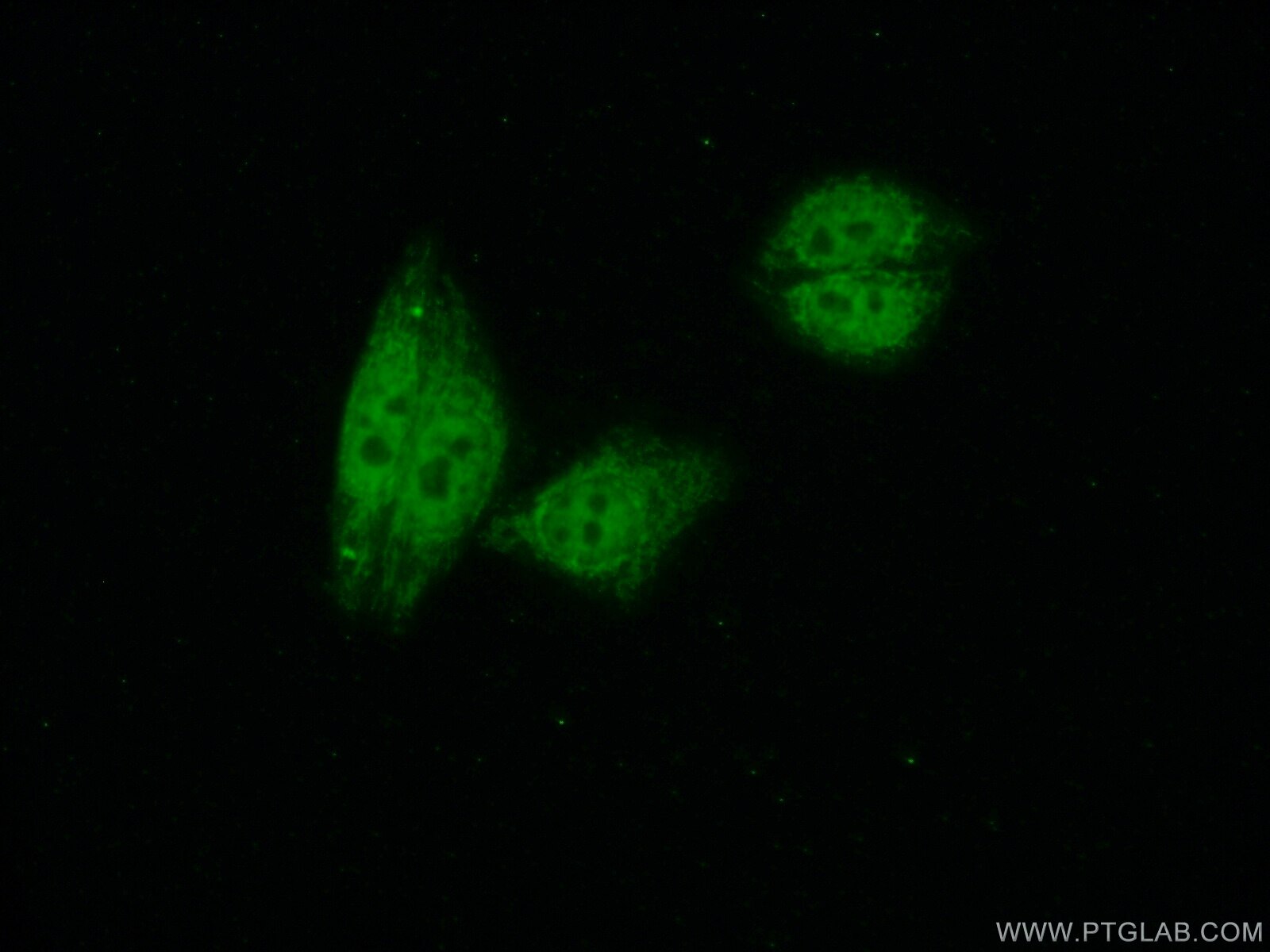 IF Staining of HepG2 using 12974-1-AP