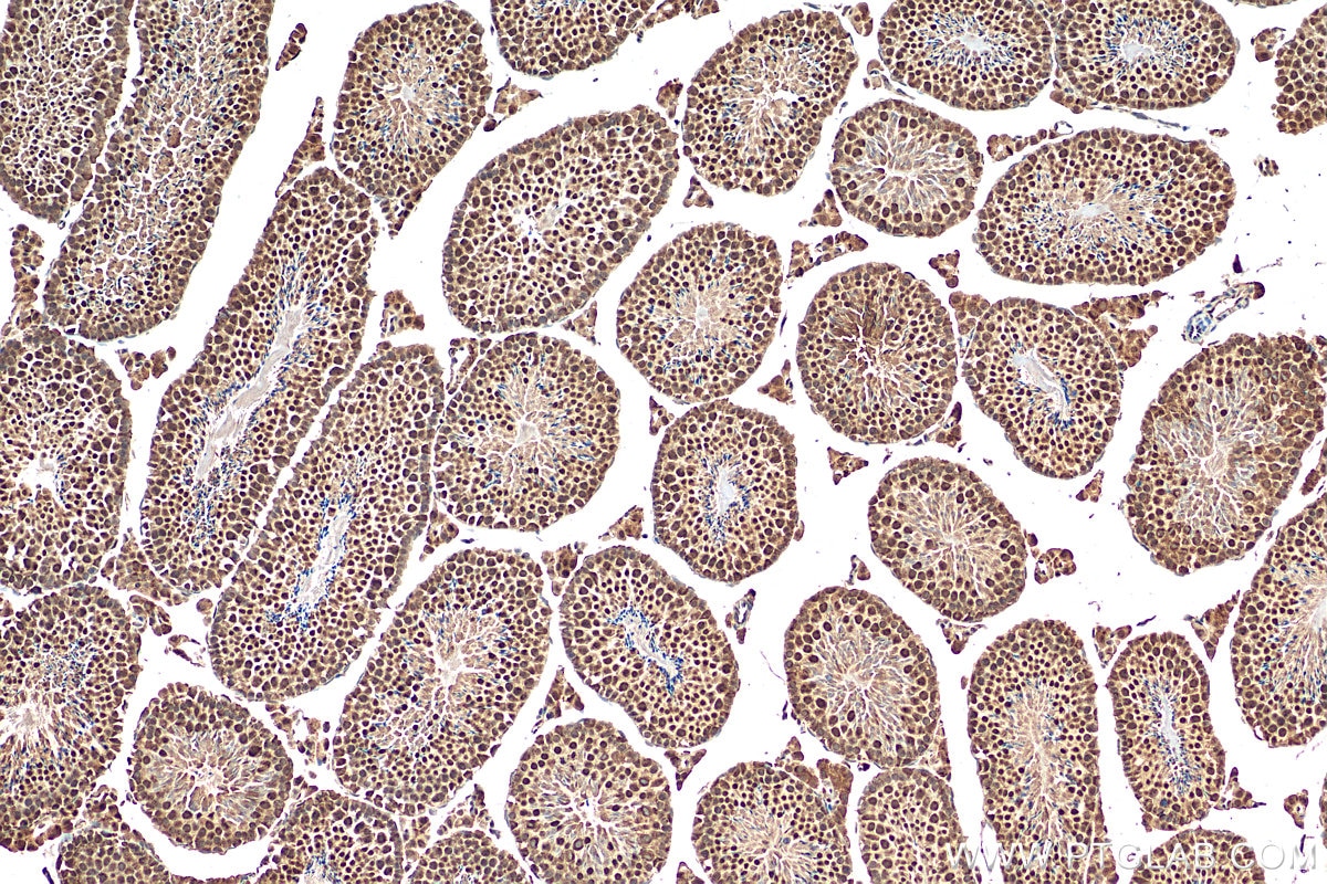 Immunohistochemistry (IHC) staining of mouse testis tissue using CDC5L Polyclonal antibody (12974-1-AP)