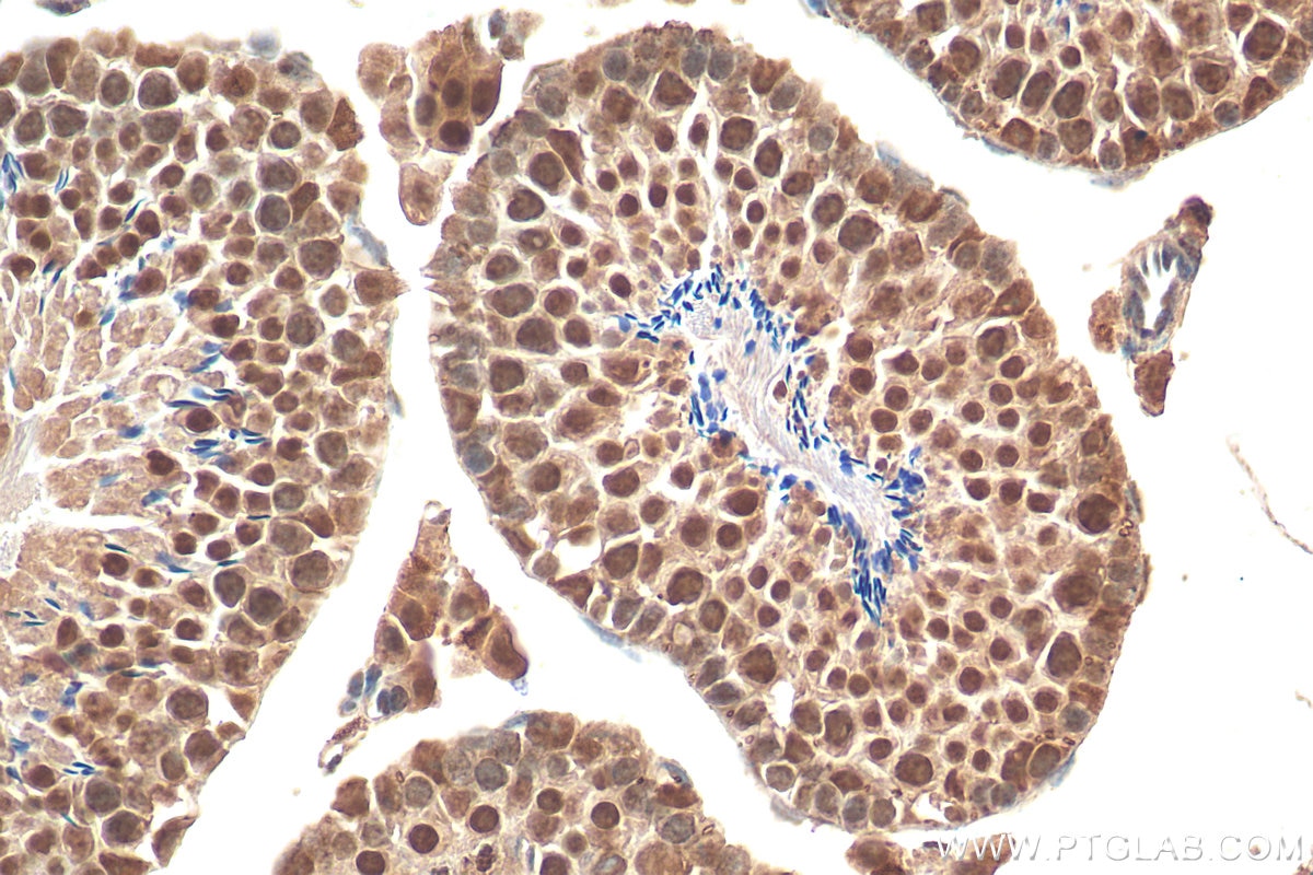 Immunohistochemistry (IHC) staining of mouse testis tissue using CDC5L Polyclonal antibody (12974-1-AP)