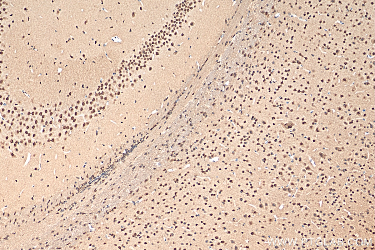 Immunohistochemistry (IHC) staining of mouse brain tissue using CDC5L Polyclonal antibody (12974-1-AP)