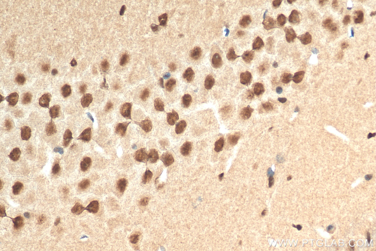 Immunohistochemistry (IHC) staining of mouse brain tissue using CDC5L Polyclonal antibody (12974-1-AP)