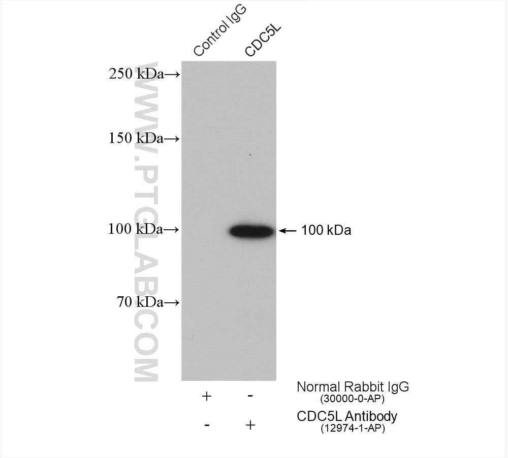 Immunoprecipitation (IP) experiment of mouse brain tissue using CDC5L Polyclonal antibody (12974-1-AP)