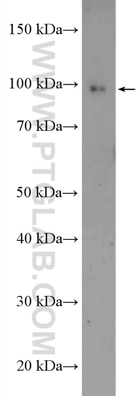 WB analysis of mouse brain using 12974-1-AP