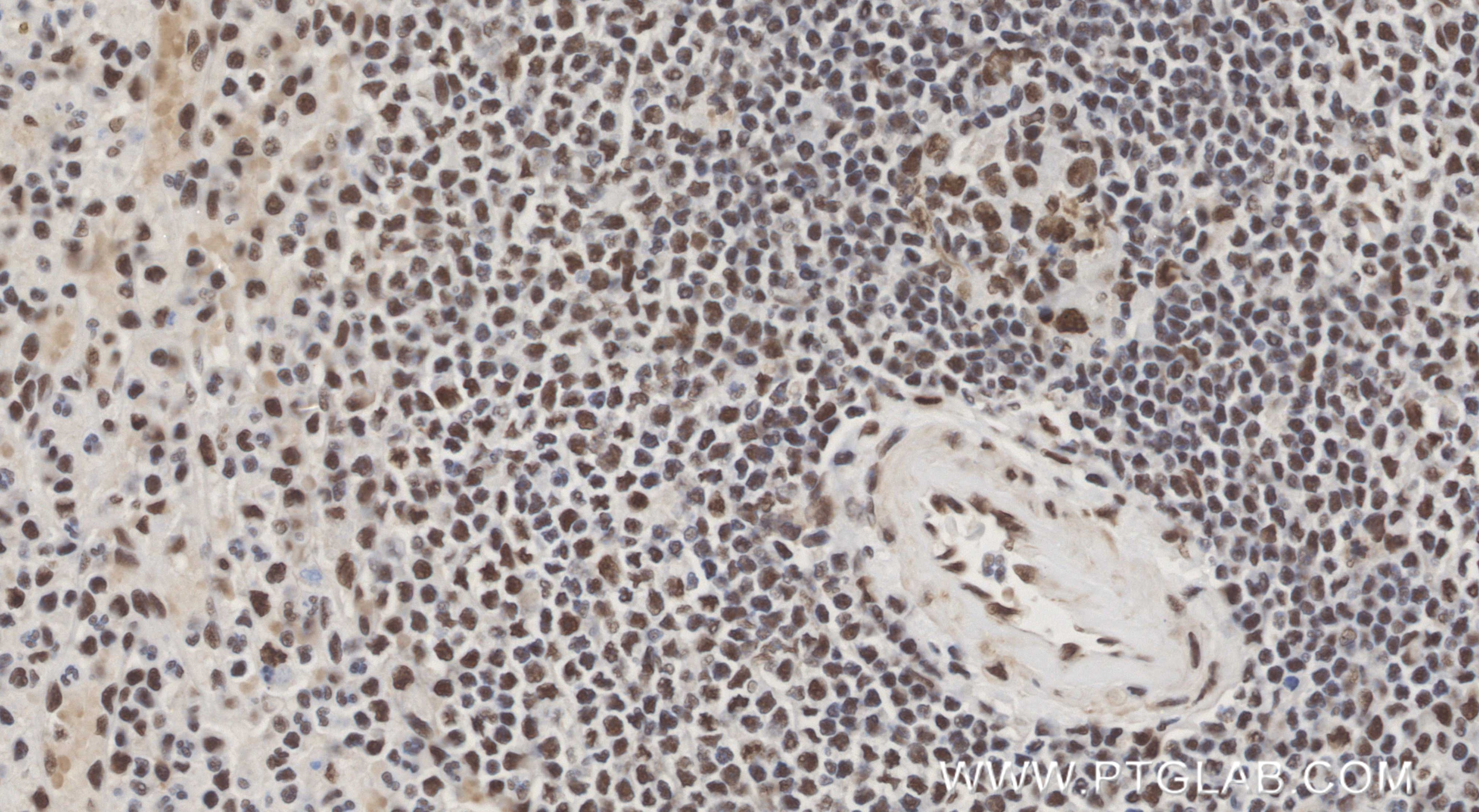 Immunohistochemistry (IHC) staining of human spleen tissue using CDC5L Recombinant monoclonal antibody (85788-5-RR)
