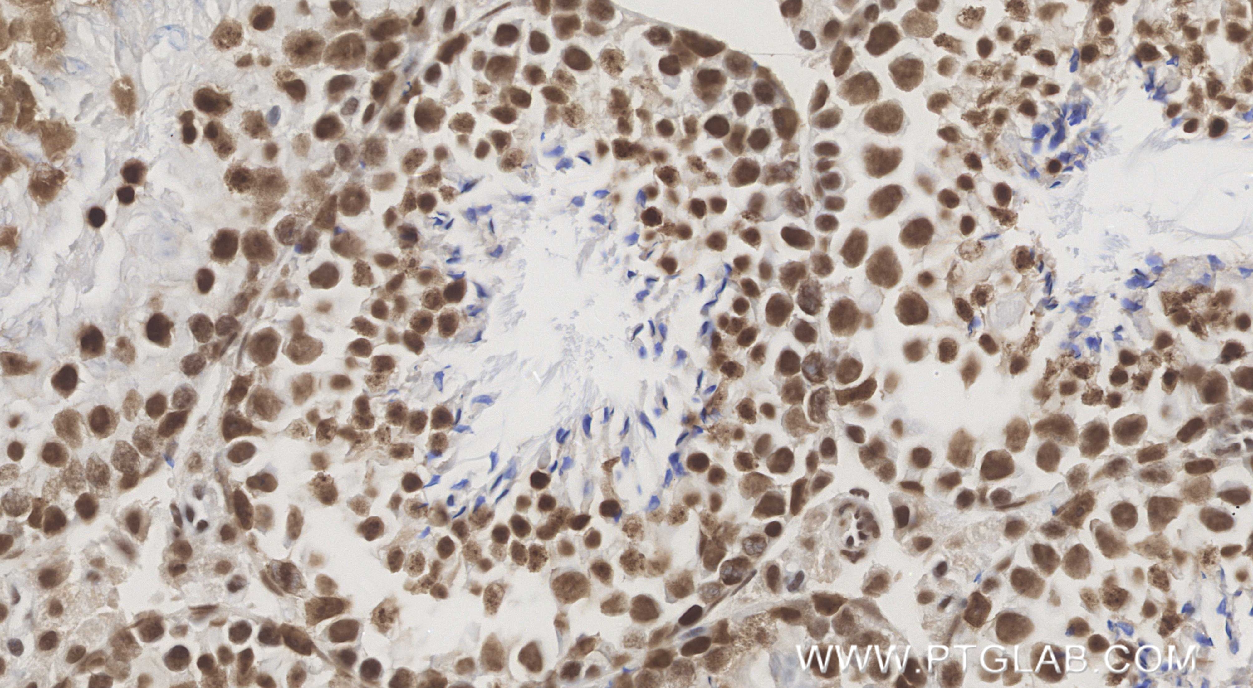 Immunohistochemistry (IHC) staining of mouse testis tissue using CDC5L Recombinant monoclonal antibody (85788-5-RR)