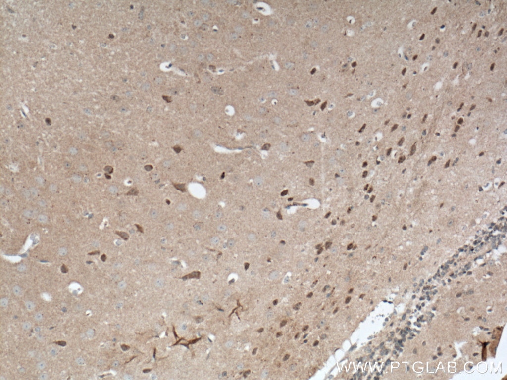 Immunohistochemistry (IHC) staining of mouse brain tissue using CDC6 Polyclonal antibody (11640-1-AP)