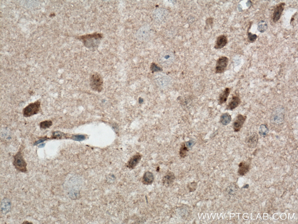 Immunohistochemistry (IHC) staining of mouse brain tissue using CDC6 Polyclonal antibody (11640-1-AP)