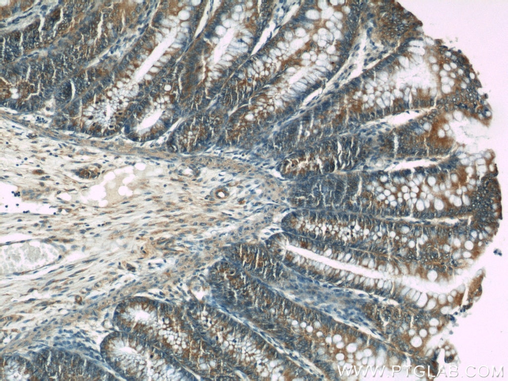 Immunohistochemistry (IHC) staining of human colon tissue using CDC6 Polyclonal antibody (11640-1-AP)