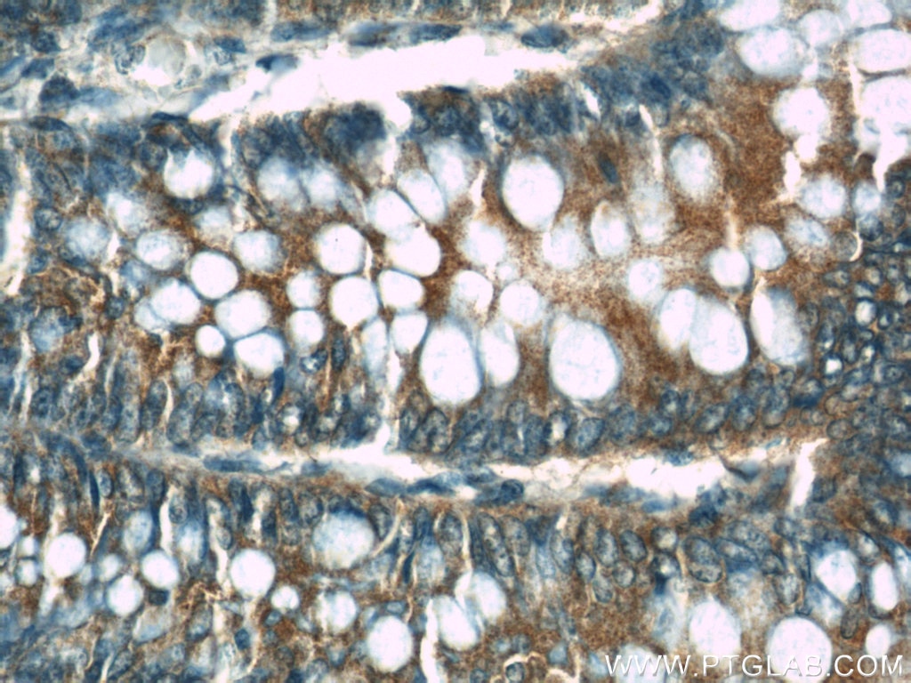 Immunohistochemistry (IHC) staining of human colon tissue using CDC6 Polyclonal antibody (11640-1-AP)