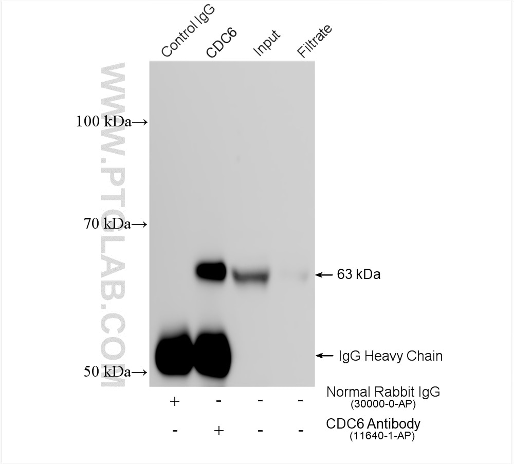 Immunoprecipitation (IP) experiment of HeLa cells using CDC6 Polyclonal antibody (11640-1-AP)