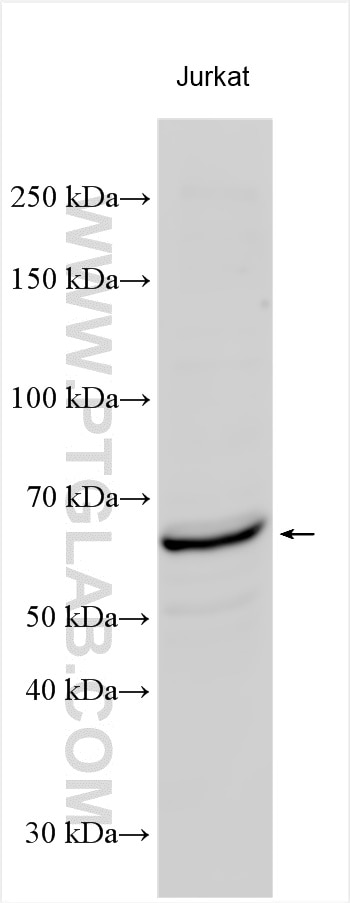 Western Blot (WB) analysis of Jurkat cells using CDC6 Polyclonal antibody (11640-1-AP)