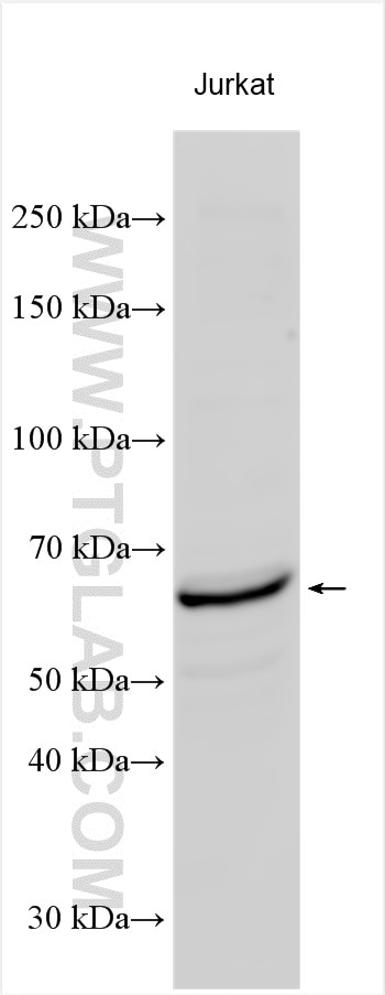 WB analysis of Jurkat using 11640-1-AP