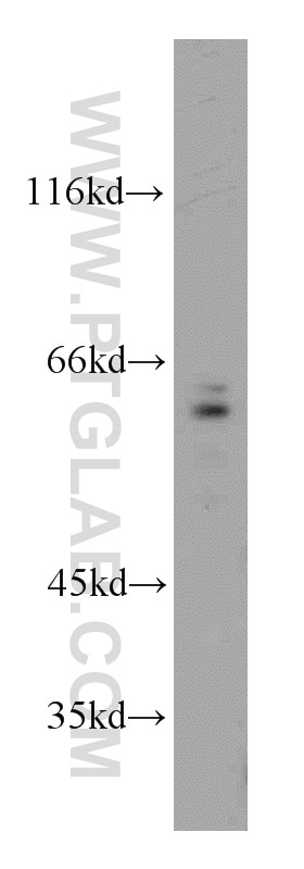 Western Blot (WB) analysis of Jurkat cells using CDC6 Polyclonal antibody (11640-1-AP)