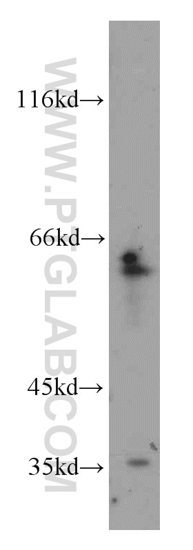 Western Blot (WB) analysis of SMMC-7721 cells using CDC6 Polyclonal antibody (11640-1-AP)