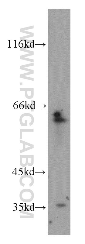 WB analysis of SMMC-7721 using 11640-1-AP