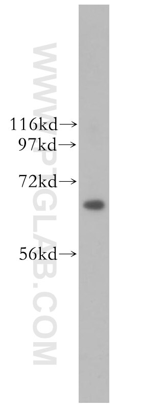 WB analysis of HeLa using 11640-1-AP