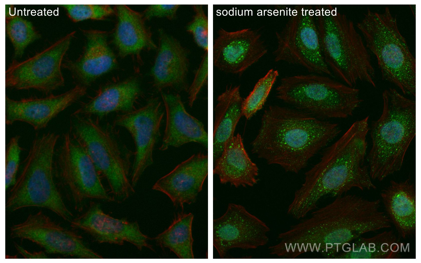 Immunofluorescence (IF) / fluorescent staining of HeLa cells using CDC6 Monoclonal antibody (66021-1-Ig)