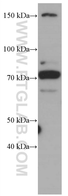 Western Blot (WB) analysis of ROS1728 cells using CDC6 Monoclonal antibody (66021-1-Ig)