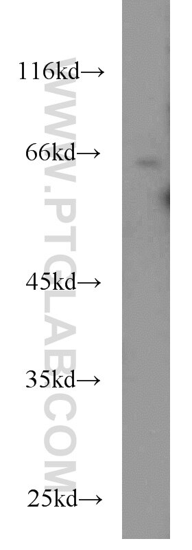 Western Blot (WB) analysis of HeLa cells using CDC6 Monoclonal antibody (66021-1-Ig)