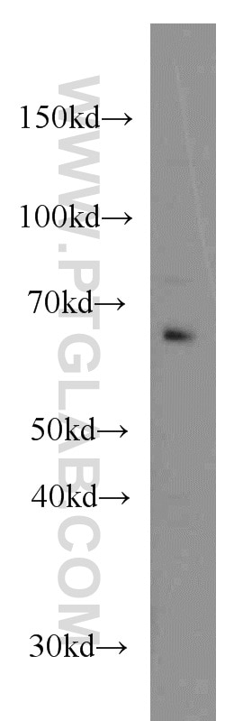 Western Blot (WB) analysis of HeLa cells using CDC6 Monoclonal antibody (66021-1-Ig)