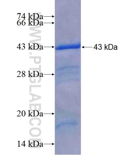 CDC6 fusion protein Ag17958 SDS-PAGE