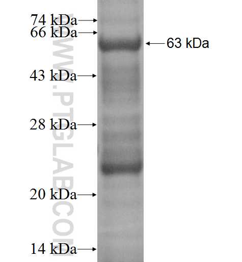 CDC6 fusion protein Ag2228 SDS-PAGE