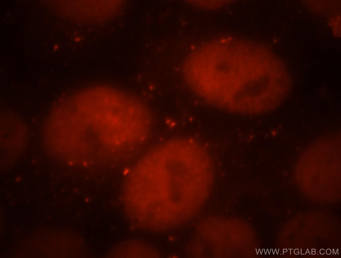 Immunofluorescence (IF) / fluorescent staining of HepG2 cells using Cdc7 Kinase Polyclonal antibody (17980-1-AP)