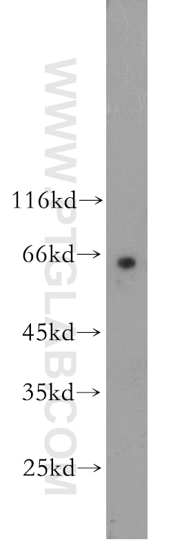 Western Blot (WB) analysis of SH-SY5Y cells using Cdc7 Kinase Polyclonal antibody (17980-1-AP)