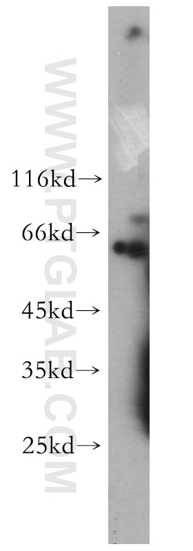 Western Blot (WB) analysis of HeLa cells using Cdc7 Kinase Polyclonal antibody (17980-1-AP)