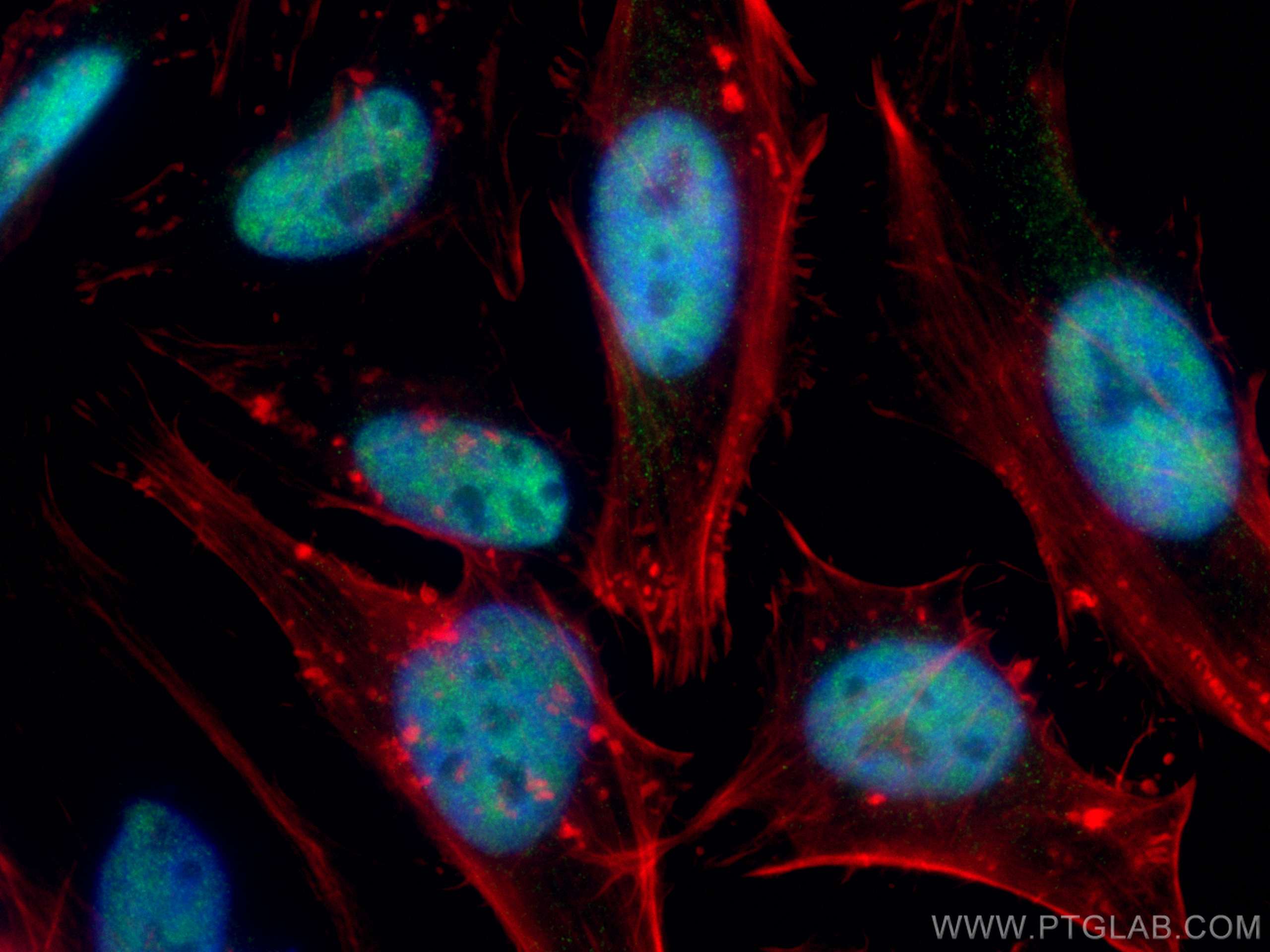 Immunofluorescence (IF) / fluorescent staining of HeLa cells using HRPT2, CDC73 Polyclonal antibody (12310-1-AP)