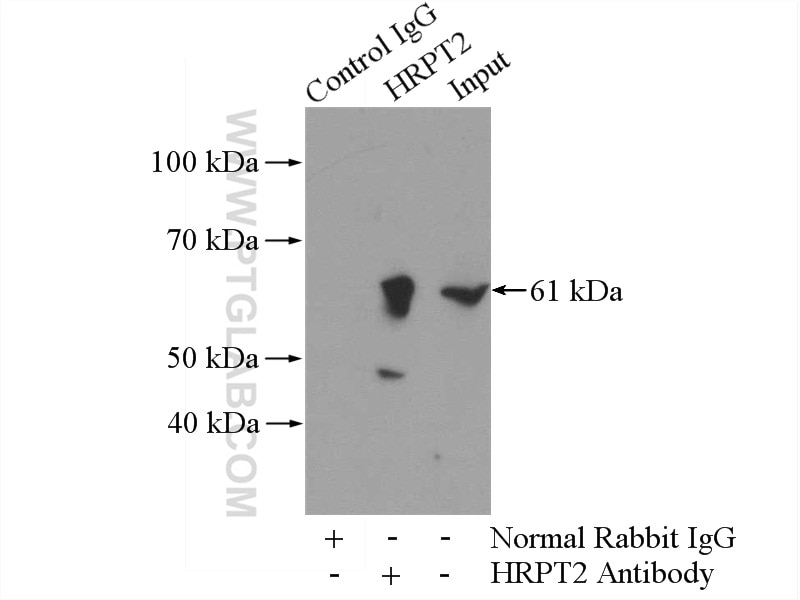 Immunoprecipitation (IP) experiment of mouse testis tissue using HRPT2, CDC73 Polyclonal antibody (12310-1-AP)
